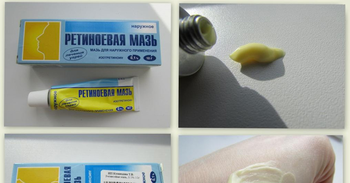 Ð ÐµÐ·ÑÐ»ÑÑÐ°Ñ Ð¿Ð¾ÑÑÐºÑ Ð·Ð¾Ð±ÑÐ°Ð¶ÐµÐ½Ñ Ð·Ð° Ð·Ð°Ð¿Ð¸ÑÐ¾Ð¼ "ÐÐ¾Ð¿ÐµÐµÑÐ½ÑÐµ ÑÑÐµÐ´ÑÑÐ²Ð° Ð´Ð»Ñ ÐºÑÐ°ÑÐ¾ÑÑ Ð¸Ð· Ð°Ð¿ÑÐµÐºÐ¸! ÐÐ±ÑÑÐ½Ð°Ñ ÐºÐ¾ÑÐ¼ÐµÑÐ¸ÐºÐ° Ð² Ð´Ð¾Ð»Ñ Ð½Ðµ Ð¿Ð°Ð´Ð°ÐµÑ"